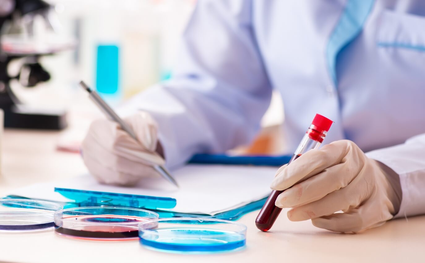 MCL-rapid-testing